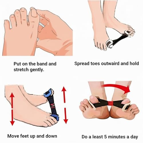 Toe Stretcher Band 2-Pack - Bunion Corrector for Big Toe Relief