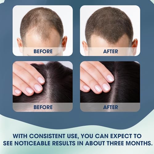Hair Growth Serum Roll-On with Biotin & Niacinamide