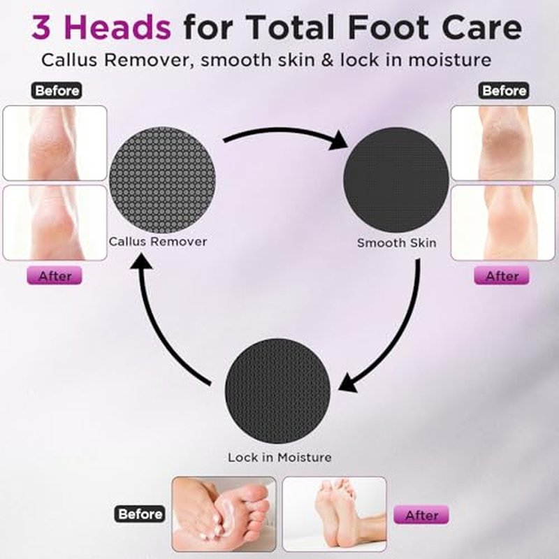 Electric Foot Callus Remover with Nano Glass Heads