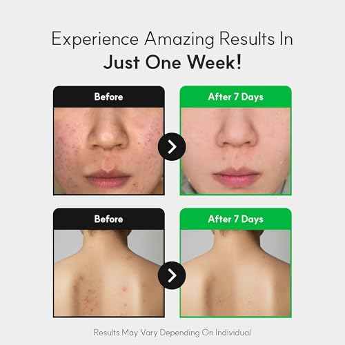 Spicule CICA Foam Cleanser, 3.38 fl oz/100ml | Hydrating Korean Face Wash with Centella Asiatica, Hyaluronic Acid & Tea Tree, Gentle Daily Cleanser for Sensitive & Acne-Prone Skin