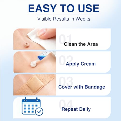 40% Salicylic Acid Wart Remover Cream - 1 oz