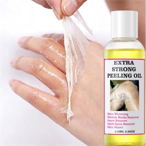 Extra Strong Peeling Oil, Yellow Peeling Oil for Dark Skin, Exfoliating Peeling Solution for Body, Hand, Feet and Face All Skin Type