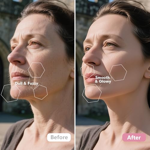 Sonic Dermaplane Razor for Women - Facial Exfoliation & Peach Fuzz Removal