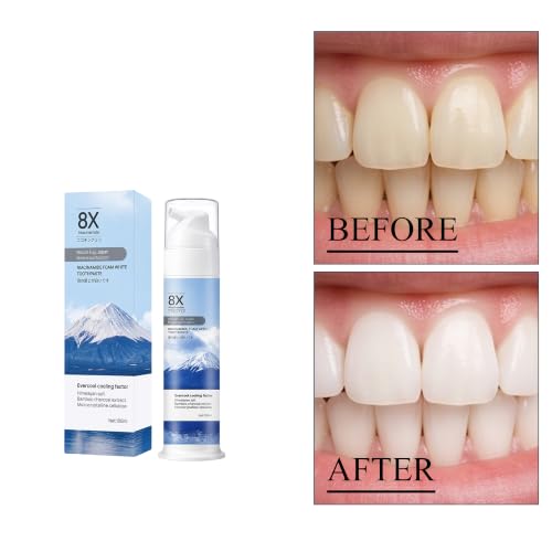 Niacinamide Foaming Toothpaste with Charcoal - Whitening, Fresh Mint, 1pc