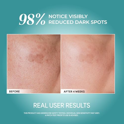Advanced Youth Rejuvenating Serum with 10% Niacinamide + Arbutin ? Brightening & Dark Spot Treatment ? 50ml
