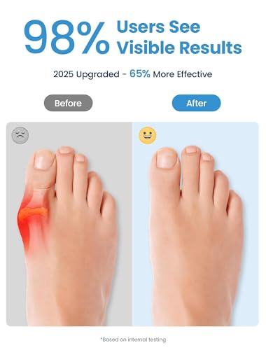 Bunion Corrector Toe Separators for Women & Men (6 Pack)