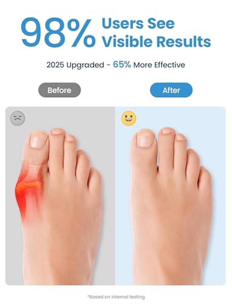Bunion Corrector Toe Separator for Big Toe - Breathable & Comfortable