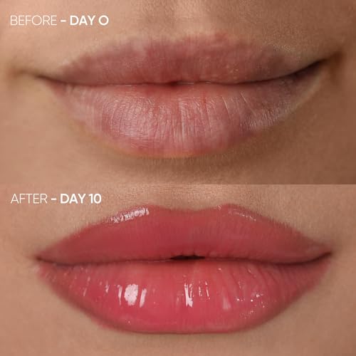 Red Light Therapy Lip Plumper Device | LED Lip Enhancement