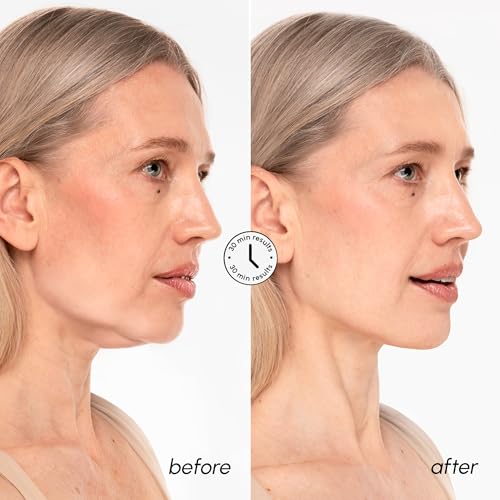 MAREE V Line Lifting Mask with 24K Gold ? Deep Collagen Face Mask for Women ? Jawline Shaper Mask with Retinol & Hyaluronic Acid ? Neck Tightening & Firming - Double Chin Strap for Face Lift - 2 pack