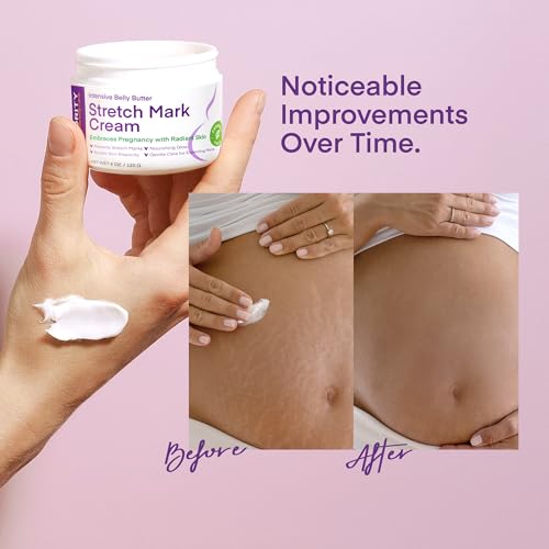 Vigority Stretch Mark Cream for Pregnancy – 4 oz Belly Butter