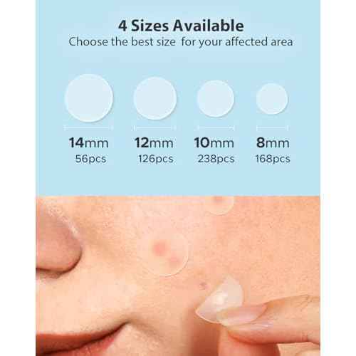LitBear Acne Pimple Patches- Day and Night 4 Sizes 588 Dots Thin & Thick Hydrocolloid Patches with Witch Hazel, Tea Tree & Calendula Oil, Extra Adhesion for Face Zit Patch Dots
