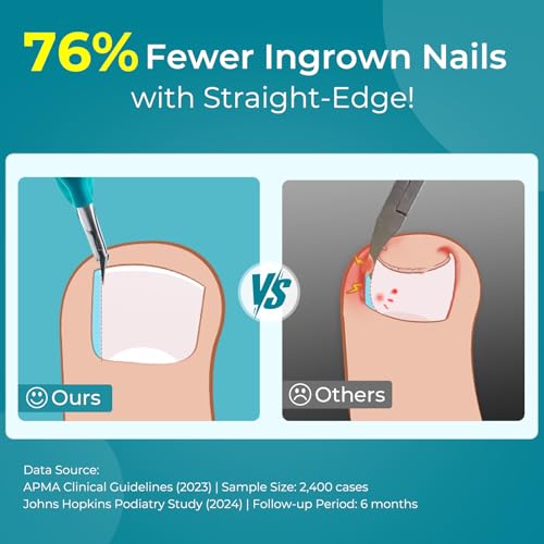 Wanmat Professional Ingrown Toenail Clipper: Straight Edge Nail Clippers for Men Women - Runners/Athletes Aged 16-45 - Compact Thick Fingernail Cutter for Gym Bag/Travel