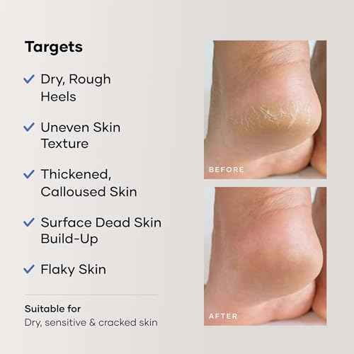 Cureskin Foot Care Cream for Cracked Heels | Repairs, Softens, and Exfoliates | Foot Cream for Women and Men, 50 g (Pack of 1)