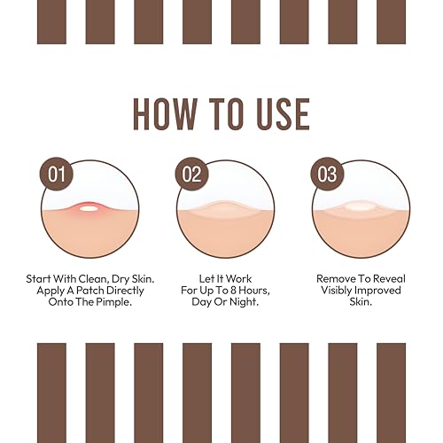 NOOD Pimple Patch ? Skin-Tone Matching, Ultra-Thin & Breathable Hydrocolloid | Discreet Pimple Coverage & Fast Healing | 20 Patches in 2 Sizes (Espresso)