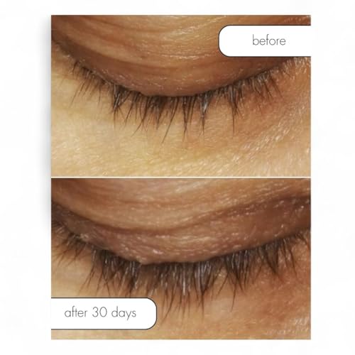 Lash Bath Eye Makeup Remover & Conditioner - 4 oz
