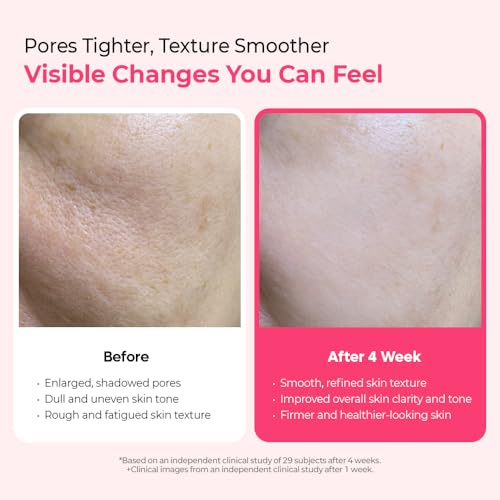Dr.Melaxin Cyano Pink Spicule Serum | Microneedle Facial Treatment, 1.01 fl.oz