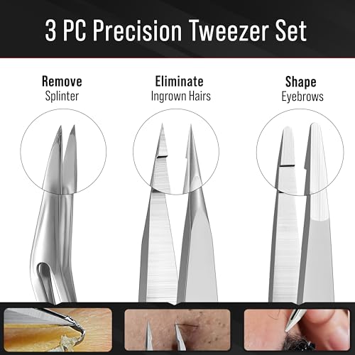 DUROX 3-Piece Tweezer Set ? 1.Pointed Ingrown Hair Tweezers, 2.Fine-Tip Splinter Tweezers, 3.Safety Round Tip for Facial & Chin Hair Removal. Made of stainless steel. Protective pouch for safe storage