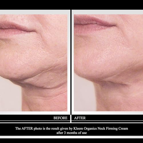 Kleem Neck Firming Cream | Retinol Moisturizer for Face & D?collet? | Anti Aging Cream for Women | Smooth Fine Lines, Wrinkles & Crepey Skin | Hydrating Collagen & Peptides | Made in USA | 1.7 oz