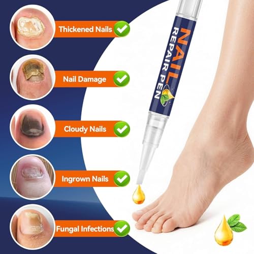 Toenail Fungus Treatment Pen | 25% Undecylenic Acid & Tea Tree Oil