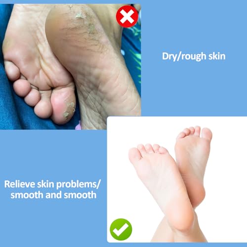 3 Pairs Cotton Moisturizing Overnight Spa Socks for Dry Feet & Cracked Heels