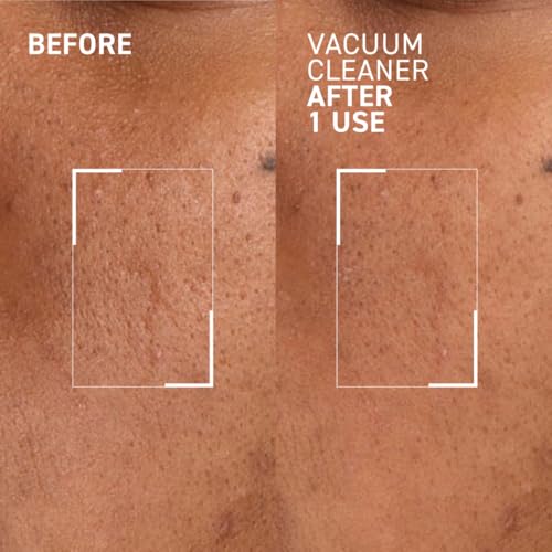 Dr. Brandt Pores No More Vacuum Cleaner - Pore-Purifying Mask to Unclog & Shrink Pores - 1 oz