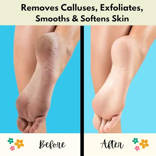 Mr. Pumice Callus Remover Pumi Bar - Foot Scrubber & Pedicure Stone (4-Pack)