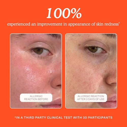 Tower 28 SOS Daily Rescue Facial Spray - Hypochlorous Acid Spray to Help Reduce Redness, Calm Irritation + Alleviate Flare-Ups - Purifying Face Toner Duo - Full + Travel Size Skin Care Spray (2 Count)