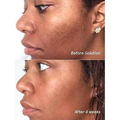 Glossier Solution exfoliating skin perfector 4.4 fl oz / 130 ml