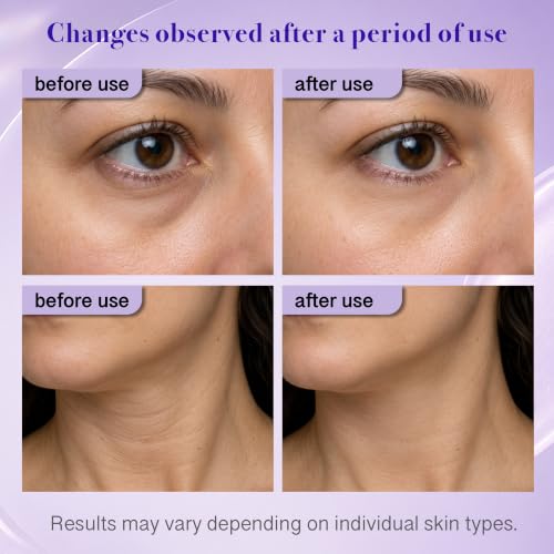 Neck & Under Eye Gel Set - Firming Cream for Women & Men