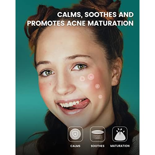 Pimple Patches 420 Counts Three Sizes, Hydrocolloid Patch Invisible with Tea Tree Oil, Acne Patches, Zit Patches for Face, Acne Spot Treatment