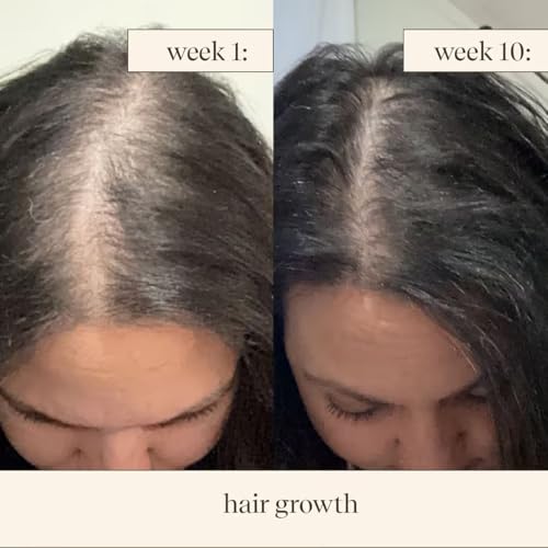 Champi Hair Oil & Moonlight Scalp Serum Duo for Hair Growth