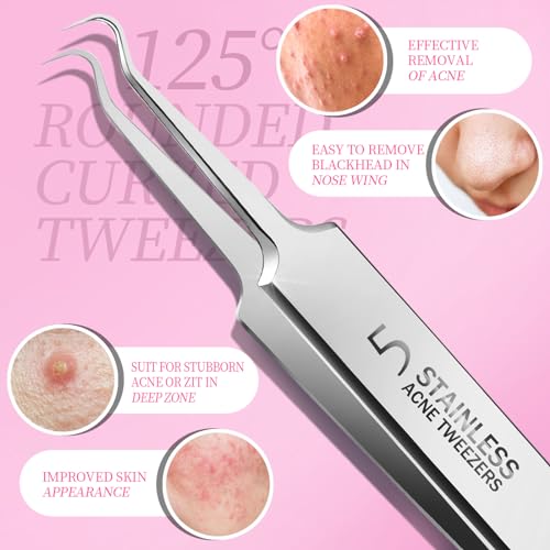 Teenitor Blackhead Remover Tool Kit - 5 Piece Acne Extraction Set
