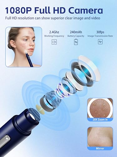 Visual Blackhead Remover with Camera 20X Extractor Kit for