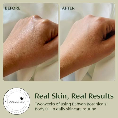 Banyan Botanicals Body Oil ? Lightweight & Non-Greasy Body Oil ? Ayurvedic Skin Care with Organic Jojoba Oil & Herbs for Soft, Smooth Skin ? 4 oz ? Non-GMO, Cruelty Free, Paraben Free Massage Oil