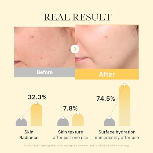 medicube Day & Night Kojic Acid Duo: Kojic Acid Turmeric Brightening Gold Jelly Gel Mask and Kojic Acid Turmeric Clarifying Toner Pad