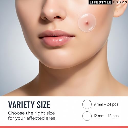 Hydrocolloid Acne Patch with Free Saline Wipe ? Invisible Skin Care Stickers for Face & Acne ? Fast Healing Pimple Patches, Stocking Stuffers for Teen Girls, (RED 72 PATCHES)
