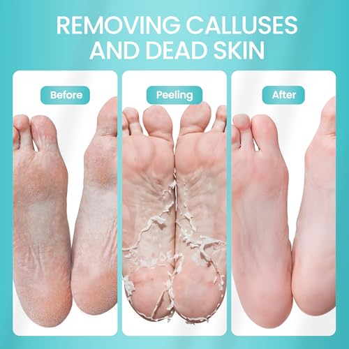 SUNATORIA Exfoliating Foot Peeling Mask (2 Pack) - Callus Remover Booties