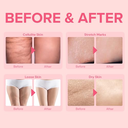 Anti-Cellulite Cream for Inner Thighs: Lifting & Firming Skin Cream for Legs with Collagen Peptides, Hyaluronic Acid, Hibiscus, and Honey - Instant Moisturizing Body Lotion for Women - 100ML