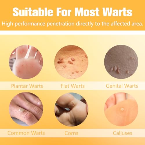 Wart Remover Liquid with 12% Salicylic Acid