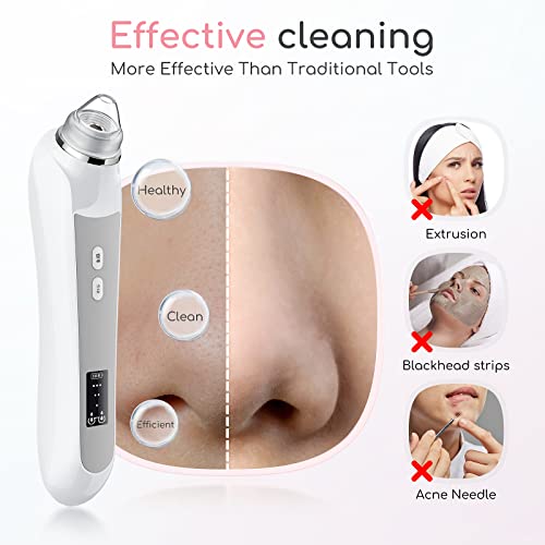 HD Camera Blackhead Remover Vacuum with LED Lighting - 3 Modes, 6 Suction Heads, Smartphone App