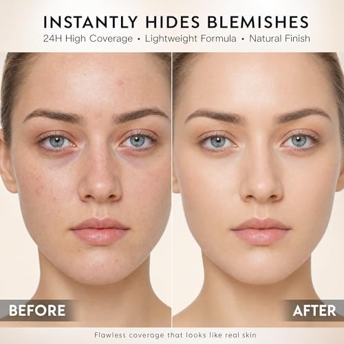 MyTend Full Coverage Concealer for Dark Circles & Mature Skin