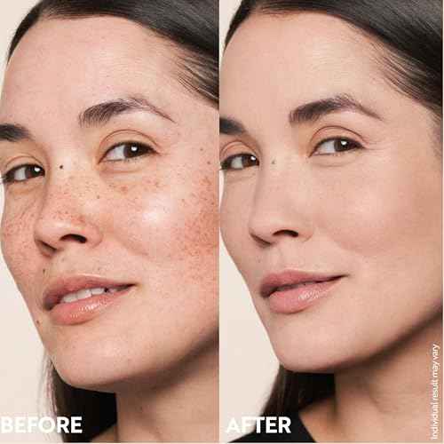 M. Asam Magic Finish Make-Up Mousse (1.01 Fl Oz) ? 4in1 Primer, Foundation, Concealer & Powder With Buildable Coverage, Hides Redness And Dark Spots, Vegan, For Light To Medium Skin Tones