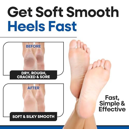 Armstrong America Moisturizing Gel Heel Socks for Cracked Heels - XL (3 Pairs)