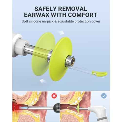 Wireless Otoscope with Gyroscope, Ear Camera with Dual View, 3.9 mm Otoscope with Light, Ear Scope with Ear Wax Removal Tool for Kids, Adults, and Pets, Compatible with iPhone and Android