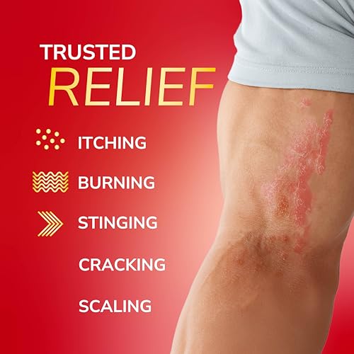 Dr. Scholl's Fungal-X Antifungal Cream for Athlete's Foot & Jock Itch - 1 oz