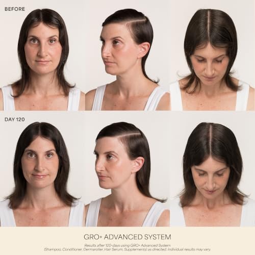 VEGAMOUR GRO+ Advanced Hair Serum - Reduce Shedding & Breakage