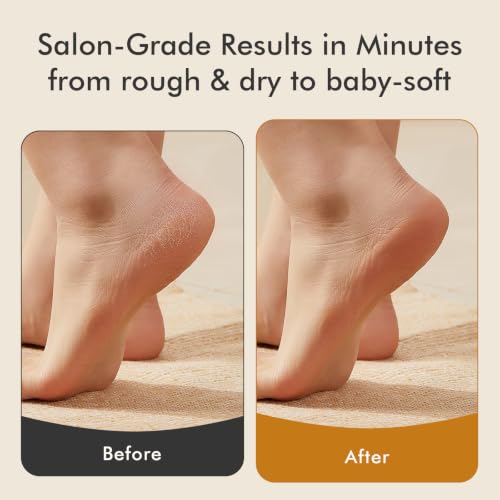 Gentle Glass Foot File Callus Remover for Smooth Feet