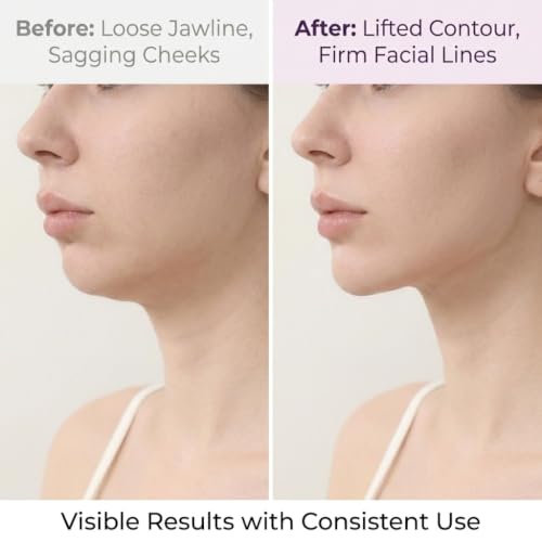 V Line Lifting Chin Strap - Double Chin Reducer & Jawline Shaper