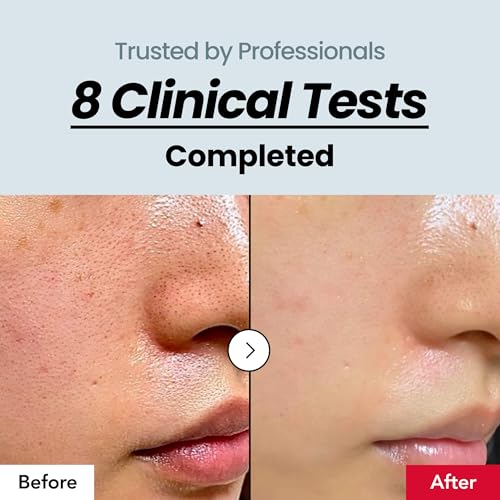 Skin Texture 27% Serum ? Rice Exfoliating, Gentle & Non-Irritating, Glass Skin, Textured Skin, Bumpy, Pore Minimizer, Retinol & Collagen, Lightweight Korean Skincare Serum, 3.04 fl oz