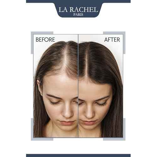 Anti-Hair Loss Tonic with Biotin, Panthenol & Caffeine | Hair Growth Treatment for Men and Women | Scientifically Proven Formula to Strengthen and Revitalize Thinning Hair by La Rachel Paris